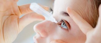 Albucid for bacterial conjunctivitis
