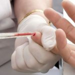 Finger prick blood test