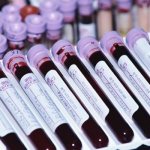 Blood tests in test tubes