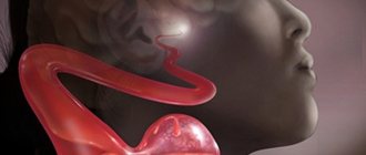 Аневризмой называют новообразование, которое формируется на сосудах головного мозга