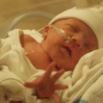 Asphyxia of newborns