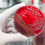 Bacteriological culture