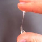 White thick discharge in women