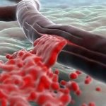 Большое внутреннее кровотечение