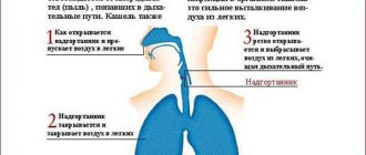 What is a cough