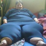 What is elephantiasis of the feet and how to treat it