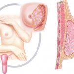 Циклодинон и алкоголь: совместимость, через сколько можно, последствия