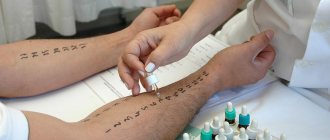 Диагностика заболевания проводится на основе кожных тестов