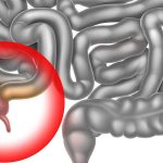 Why does a person need an appendix and what function does it perform in the body?