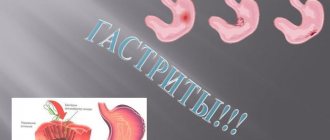 Дуодено гастральный рефлюкс гастрит