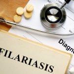 Filariasis symptoms in humans