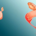 Hypoplasia of the uterus. What is it, degrees, is it possible to get pregnant, treatment 