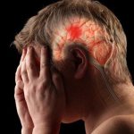 A cerebral infarction or ischemic stroke is a blockage of blood vessels in the brain in one way or another, due to which an area of ​​the brain is left without blood supply and dies.