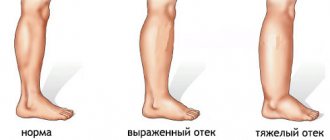 Инструкция по применению препарата лиотон: особенности использования, отзывы и цена
