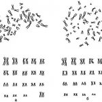 Image of a normal karyotype (set of chromosomes) of a healthy woman (a) and man (b). Normally, in a healthy person, it consists of 46 chromosomes. The differences between male and female karyotypes lie in the last pair. In women, chromosome 45-46 is XX, in men it is XY. 