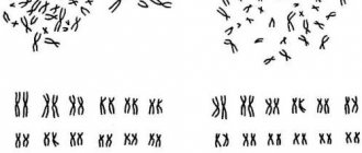 Image of a normal karyotype (set of chromosomes) of a healthy woman (a) and man (b). Normally, in a healthy person, it consists of 46 chromosomes. The differences between male and female karyotypes lie in the last pair. In women, chromosome 45-46 is XX, in men it is XY. 
