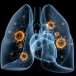 как лечить пневмонию