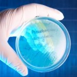 Как лечить синегнойную палочку