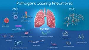 Как можно заразится вирусной пневмонией?