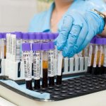 As a rule, a woman should have a coagulogram when planning a child or to identify inflammation in the body