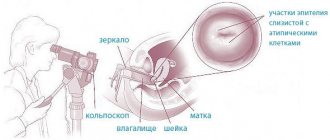 How is colposcopy performed?