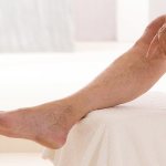 Как улучшить кровообращение в ногах у пожилых людей.