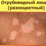 Как выглядит патология