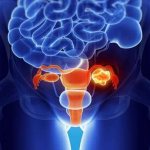 Как выглядит воспаление правого яичника у женщины