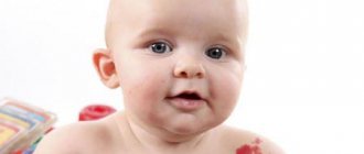 Как вылечить гемангиому в домашних условиях