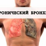 How to cure chronic bronchitis forever - News4Health.ru