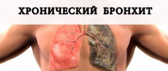 Как вылечить хронический бронхит навсегда - News4Health.ru