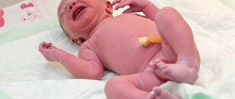 Кефалогематома у новорожденных на голове: причины, как лечить, профилактика
