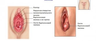 Киста бартолиновой железы что это