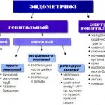Classification of endometriosis
