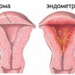 Classification - Image No. 1