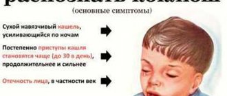 коклюш