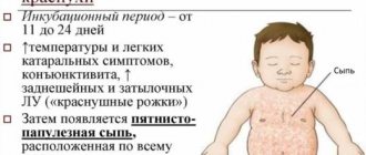 Rubella in children. Symptoms and treatment, photo of the rash, stage, what it looks like, manifests itself, is tolerated, routes of transmission. Incubation period