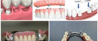 Кто такой стоматолог ортопед и что он делает