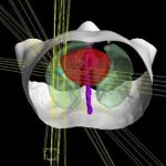 radiation therapy in oncology reviews