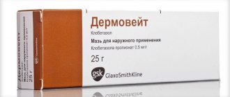 ointment for the treatment of psoriasis and eczema Dermovate