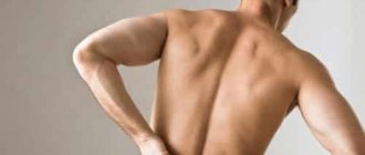 Ointment is prescribed for pain due to radiculitis