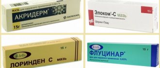 ointments for psoriasis