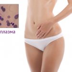 Мельчайший организм - микоплазма, способен вызывать инфекционное заболевание «микоплазмоз»