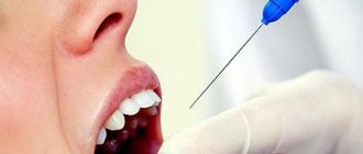 local anesthesia