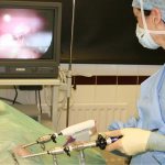 Методы удаления новообразования на яичнике