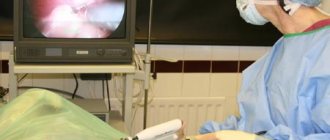 Methods for removing tumors on the ovary