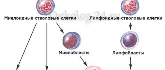 Миелобластный лейкоз