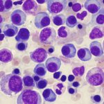 blood myeloma