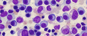 blood myeloma