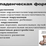 Младенческая форма болезни Помпе